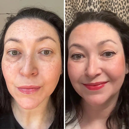 Curcuvera — Bálsamo de Cúrcuma para Contorno de Ojos