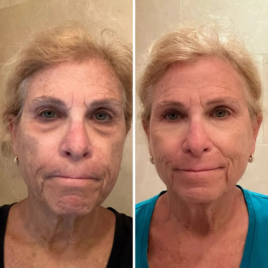 Curcuvera — Bálsamo de Cúrcuma para Contorno de Ojos