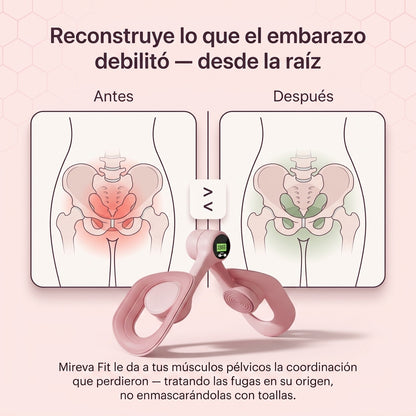 Mireva Fit™ Entrenador de Suelo Pélvico