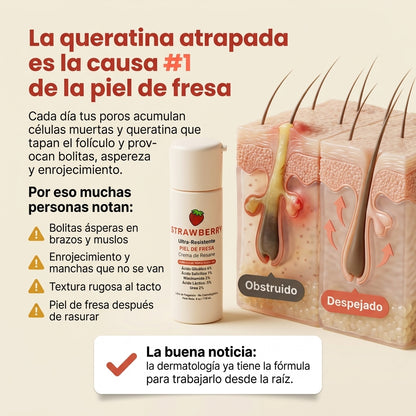 Strawberry - Crema Renovadora Triple Ácido + B3