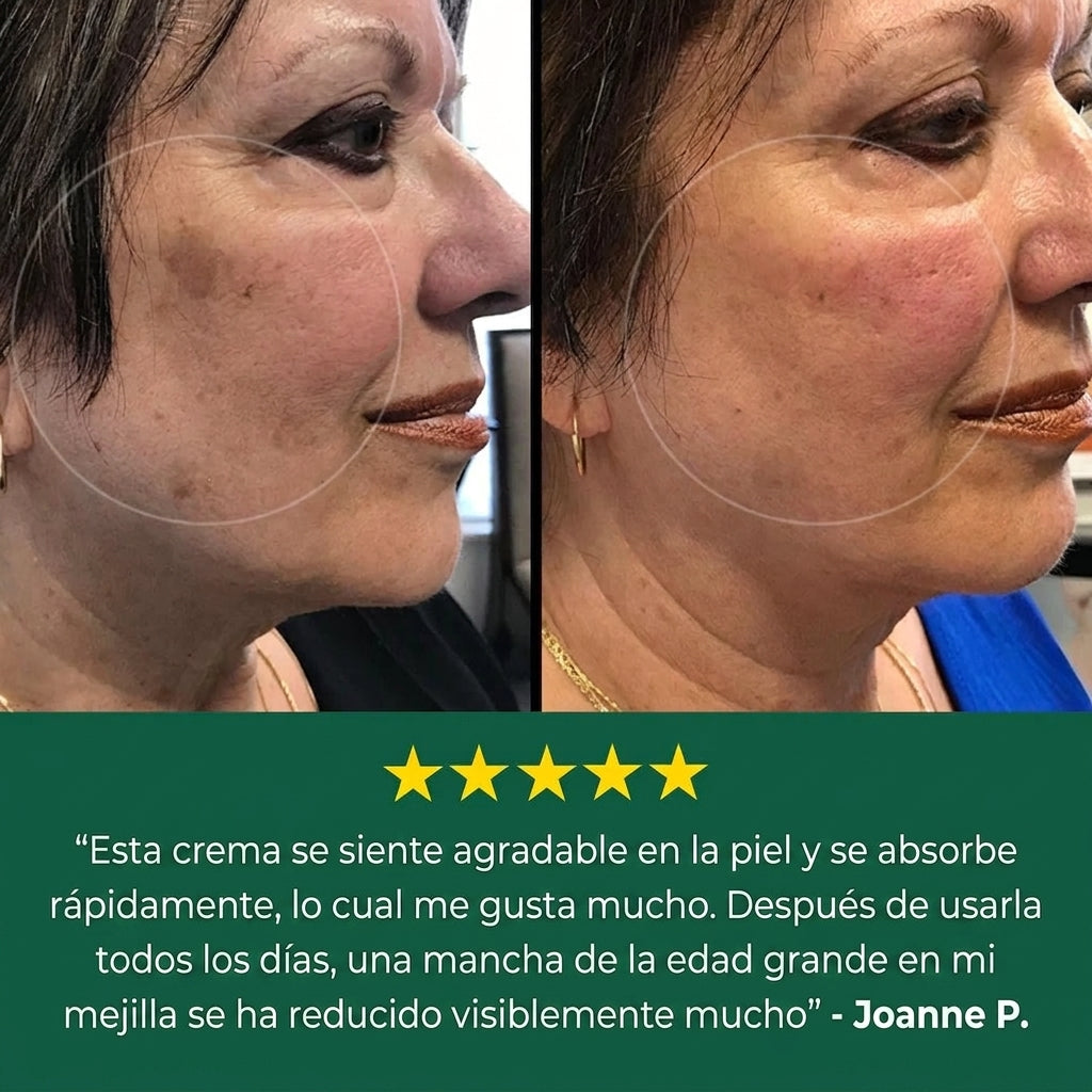 Bialvi — Crema Correctora de Manchas