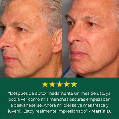 Bialvi — Crema Correctora de Manchas