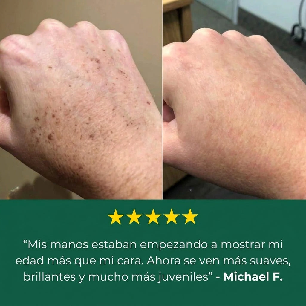 Bialvi — Crema Correctora de Manchas