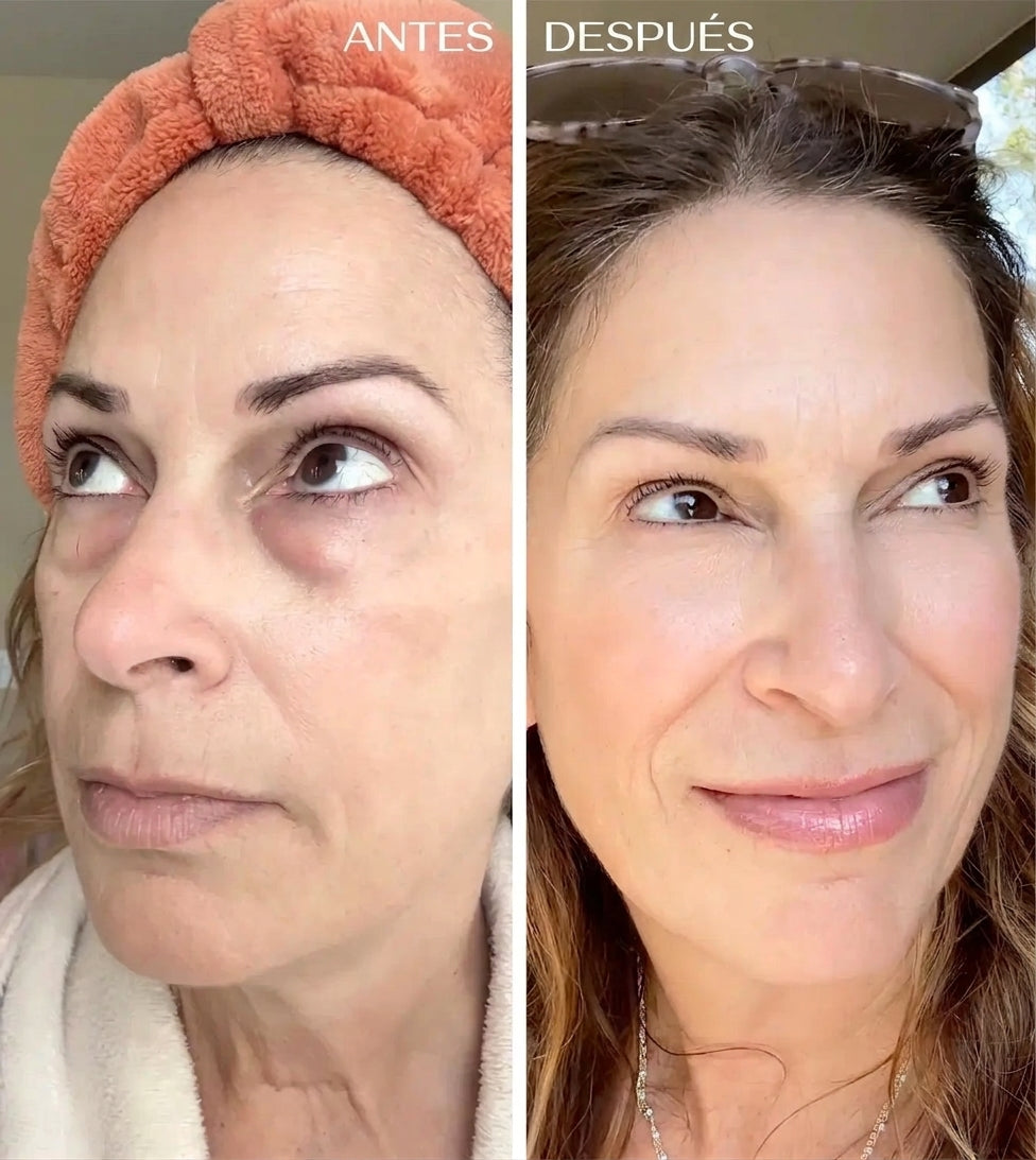 Curcuvera — Bálsamo de Cúrcuma para Contorno de Ojos