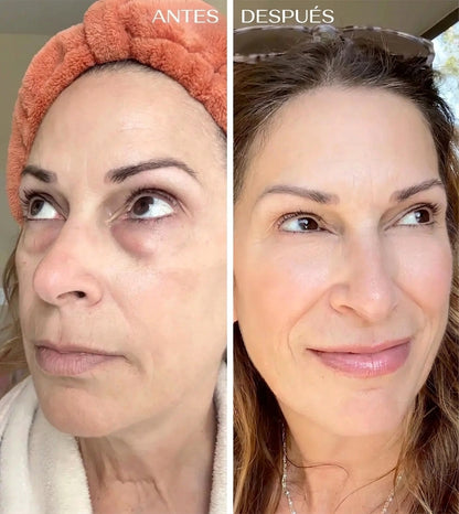 Curcuvera — Bálsamo de Cúrcuma para Contorno de Ojos
