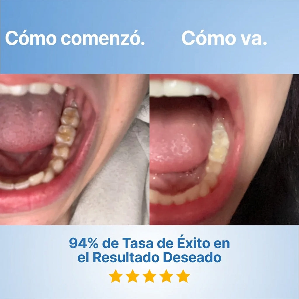 Galnex Tooth Repairing Powder