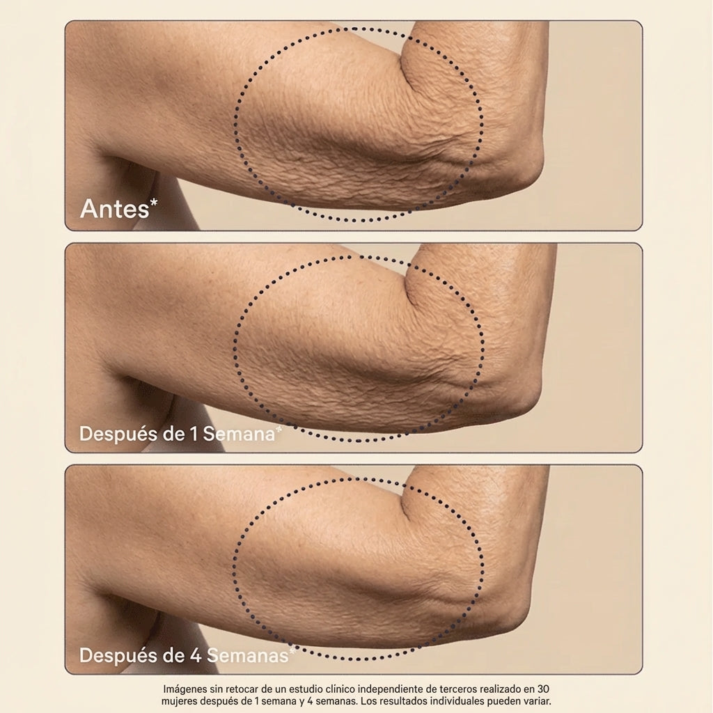 Crepey Skin Repair Cream